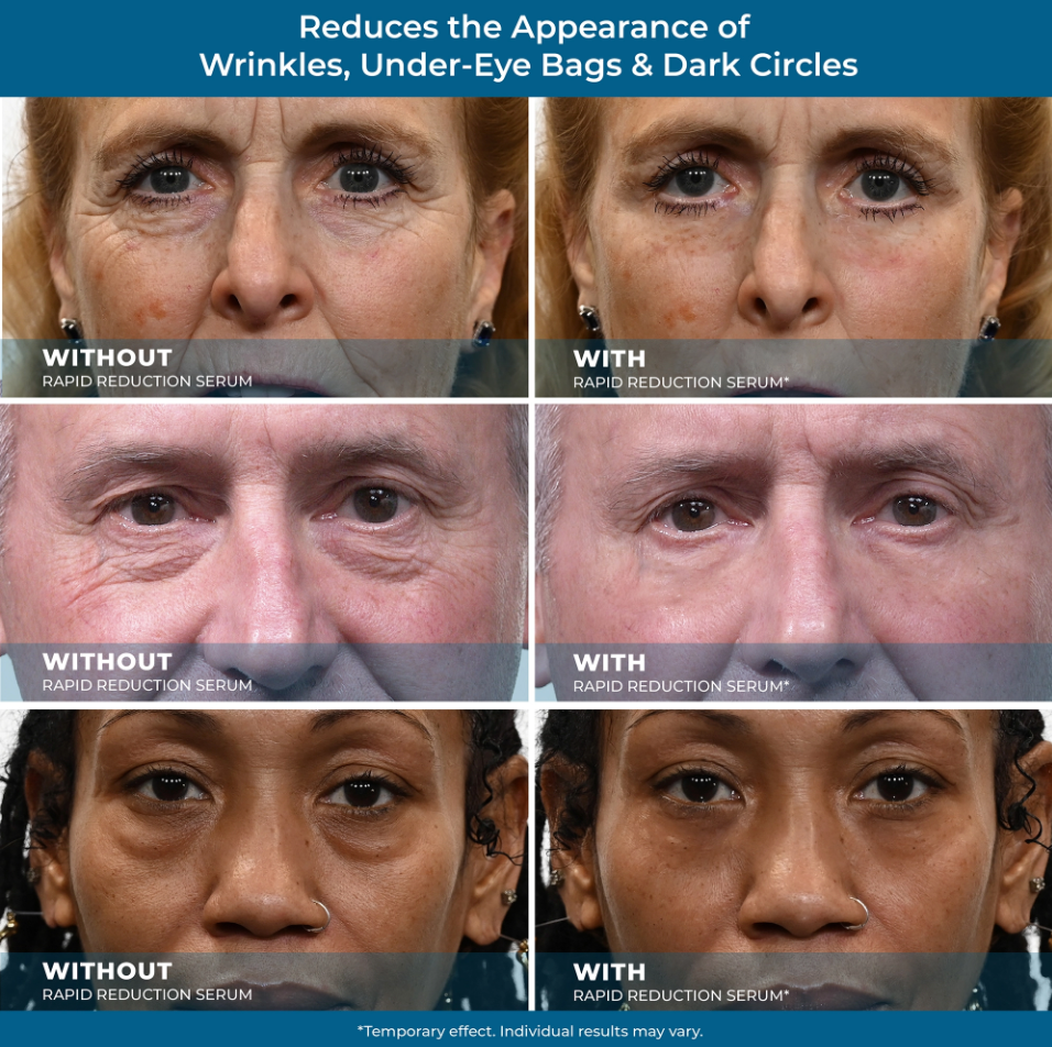 Rapid Renewal Eye & Wrinkle Serum
