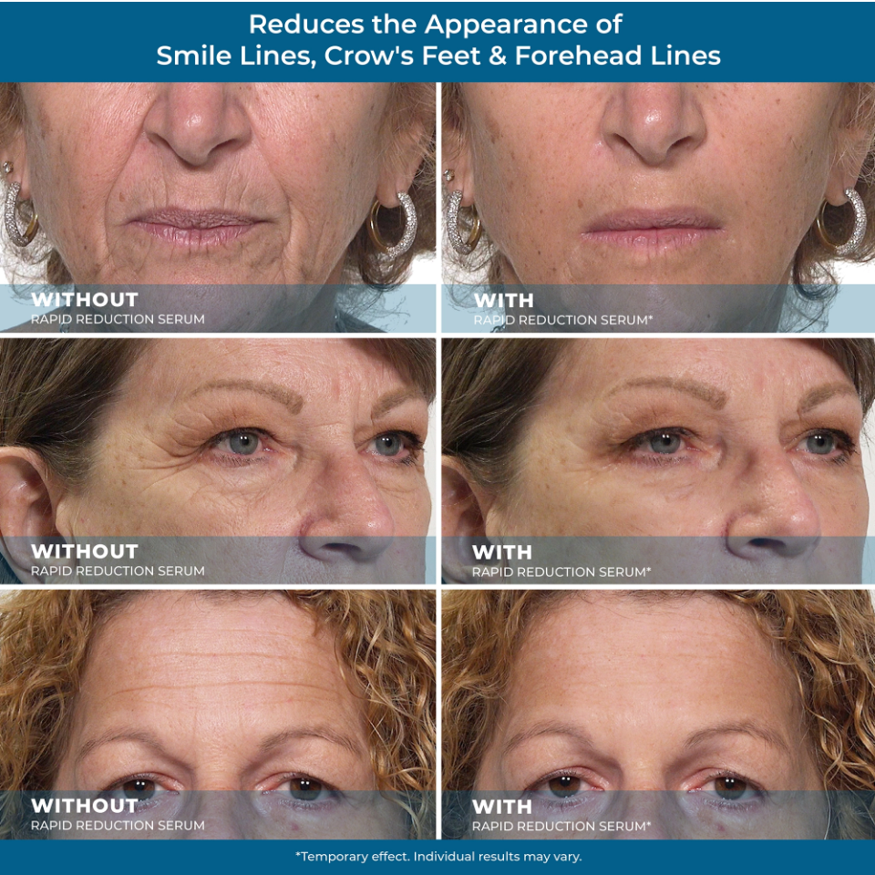 Rapid Renewal Eye & Wrinkle Serum