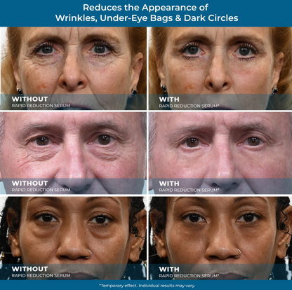 Rapid Renewal Eye & Wrinkle Serum