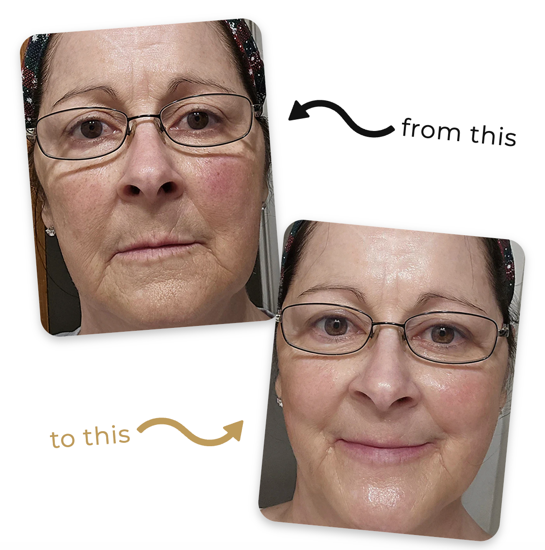 Deep Collagen Lifting Peptide