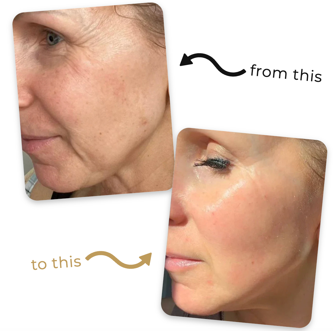 Deep Collagen Lifting Peptide